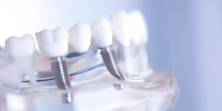 Quem tem implante dentário pode fazer ressonância