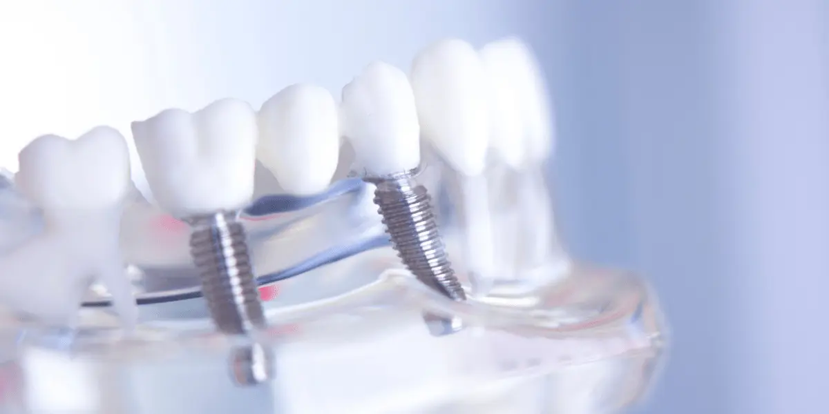 Quem tem implante dentário pode fazer ressonância magnética