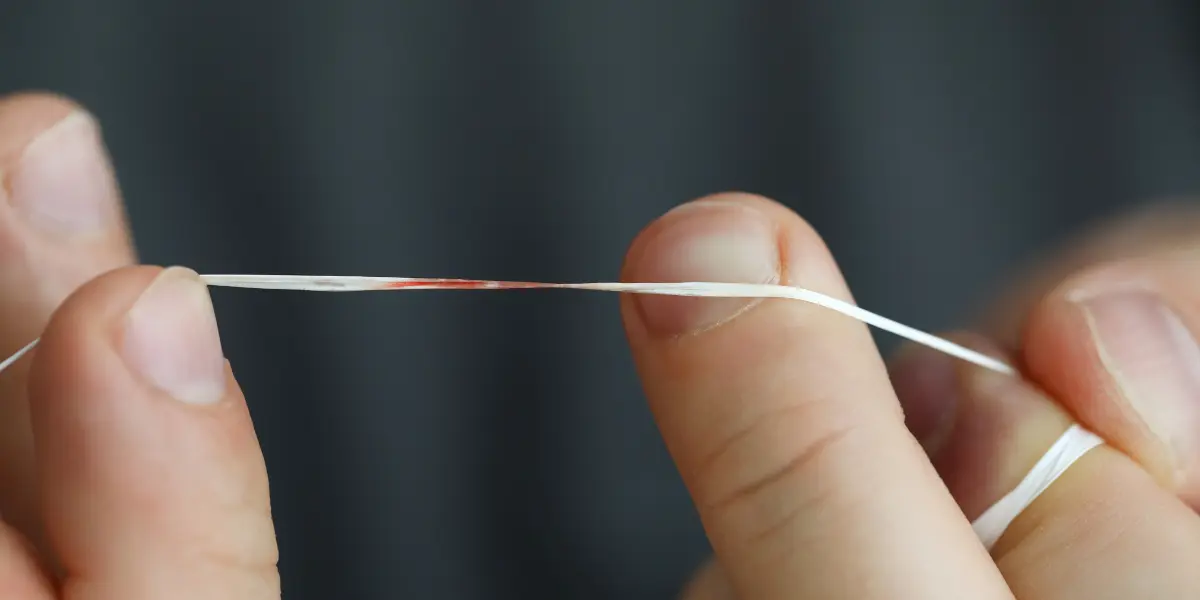 Gengiva sangrando quando passa fio dental: Causas e tratamentos