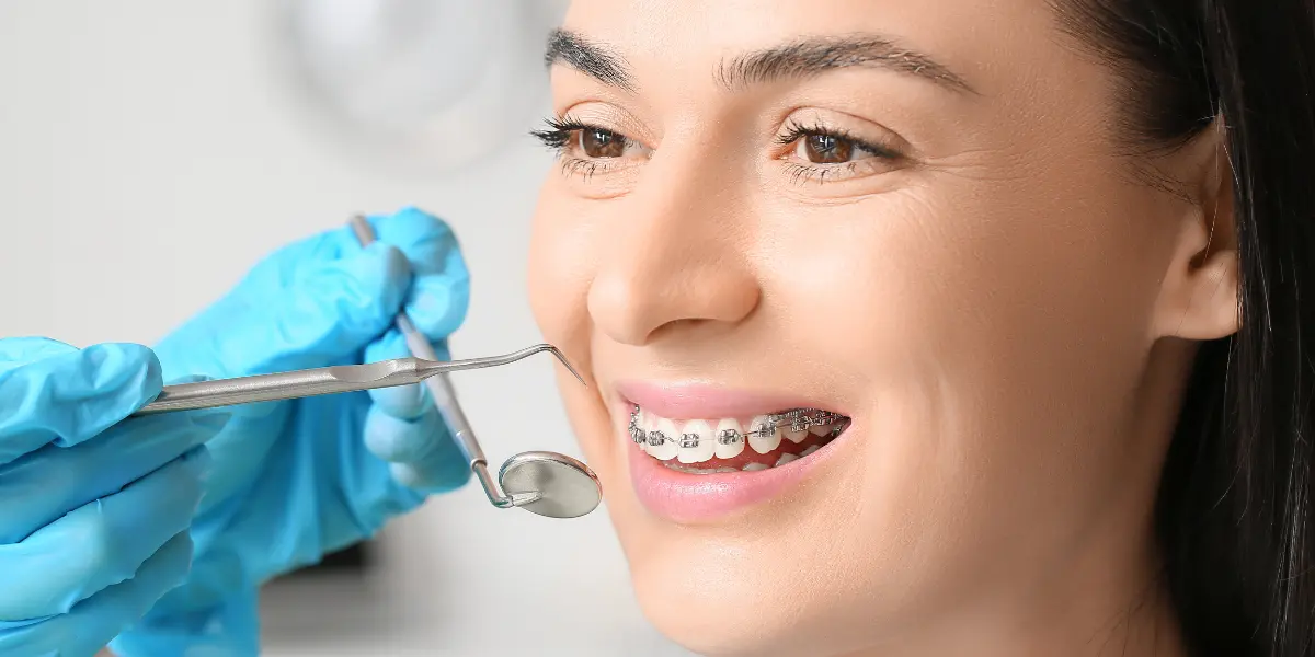 Aparelho Ortodôntico em Taguatinga OdontoLinea