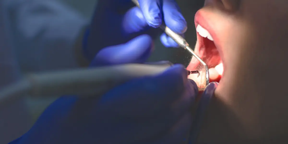 Quem não pode fazer implante dentário: restrições e contraindicações