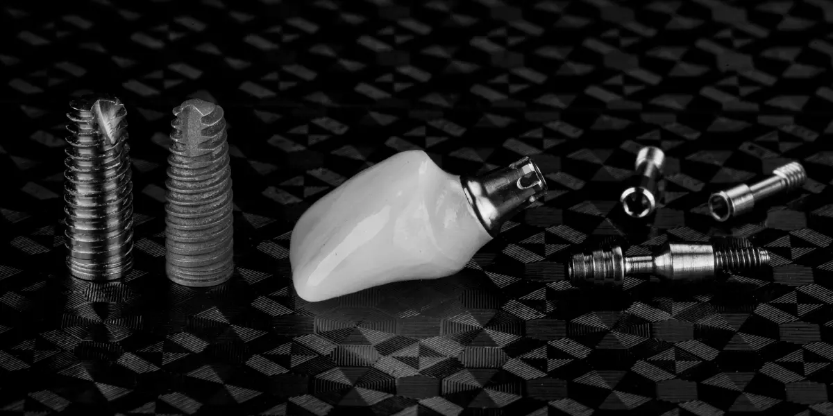 É normal o pino do implante ficar mole? Entenda aqui!