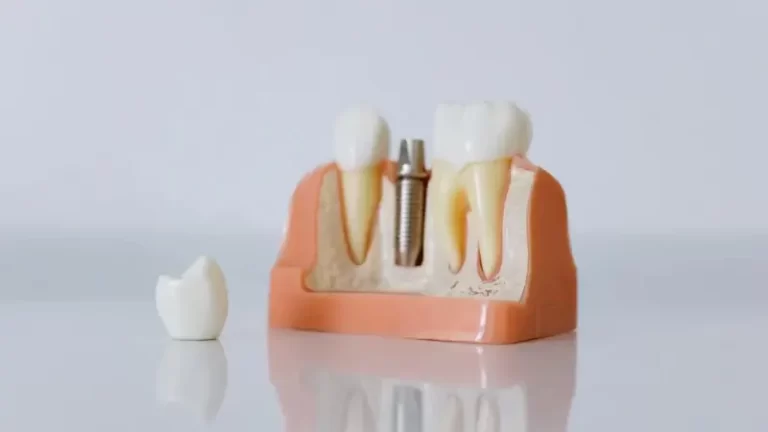 Quais os riscos de fazer um implante de prótese dentaria