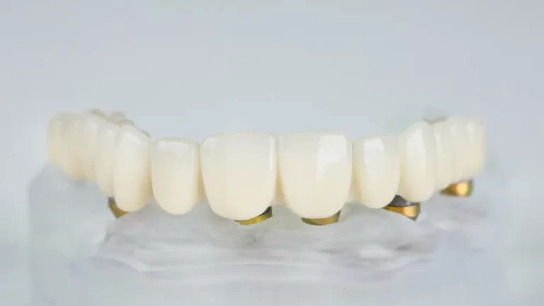 Prótese protocolo de porcelana