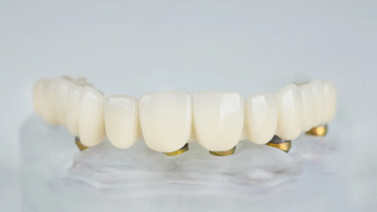 Prótese protocolo de porcelana em Brasília Clínica OdontoLinea: Elegância e Durabilidade