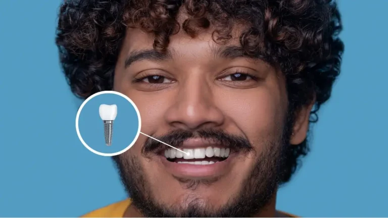 Por que o dente do implante solta