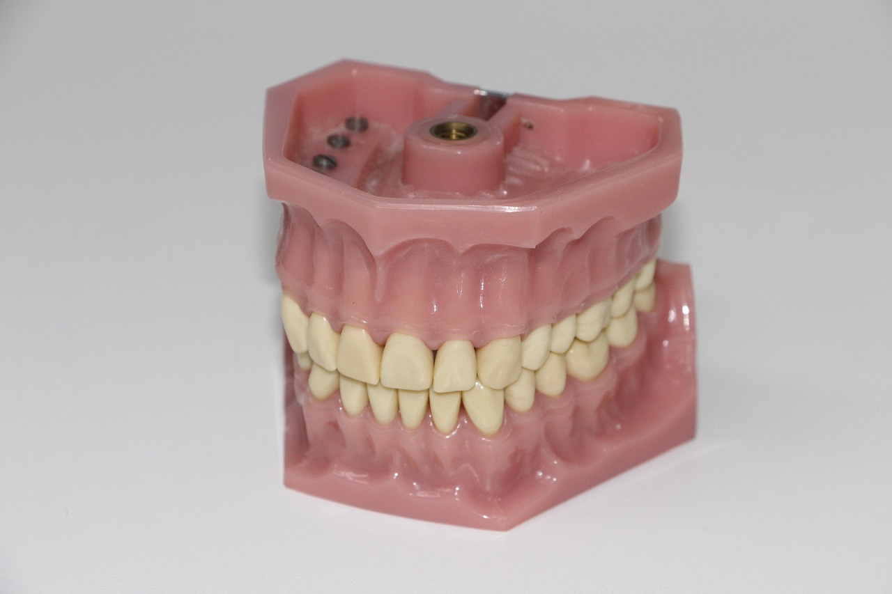 Quanto custa uma prótese dentária