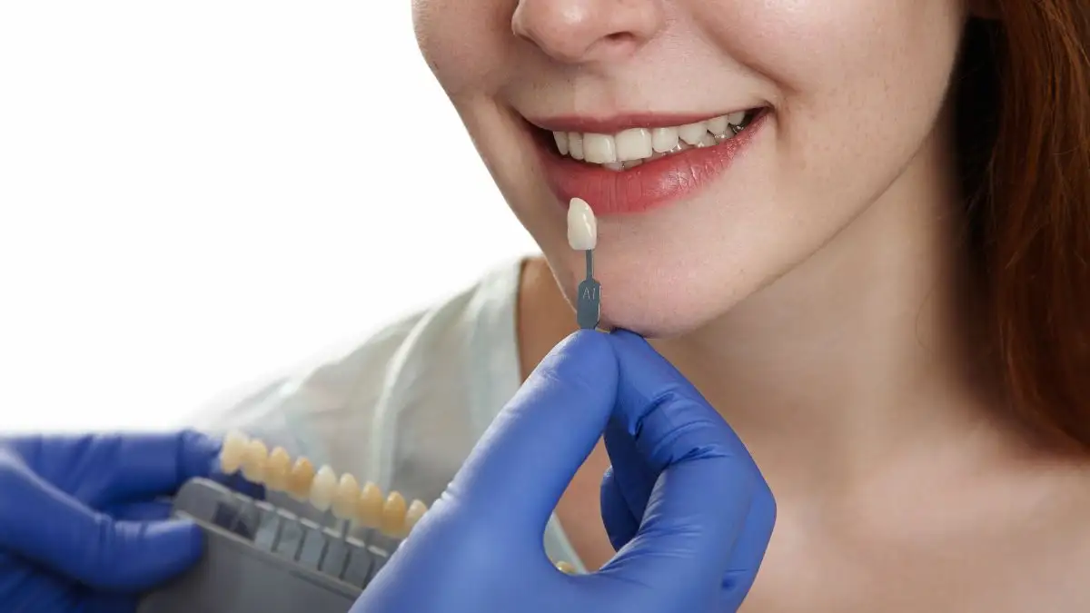 O que é faceta dentária: tipos, indicações e cuidados