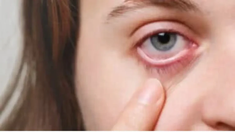 Infecção no dente pode afetar os olhos