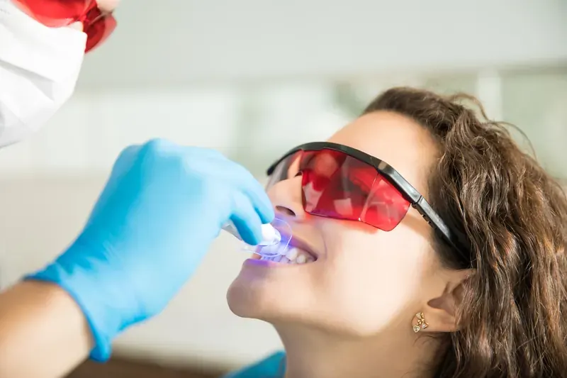 Clareamento Dental em Taguatinga - Clínica OdontoLinea