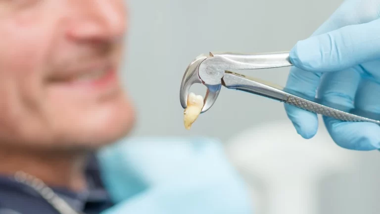 Qual dentista faz extração