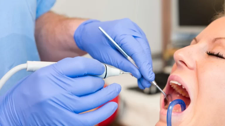 Qual dentista faz limpeza de tártaro